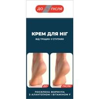 Купити Крем для ніг До і після від тріщин у ступнях по 150 мл Крем для ніг До і після від тріщин у ступнях по 150 мл